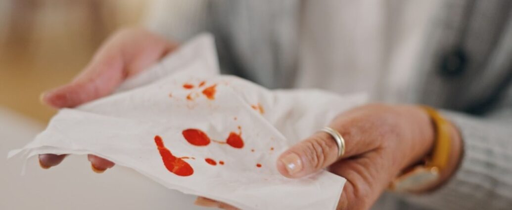 Plamy z krwi na białej chusteczce