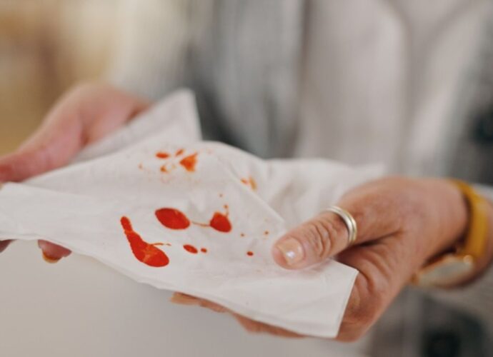 Plamy z krwi na białej chusteczce
