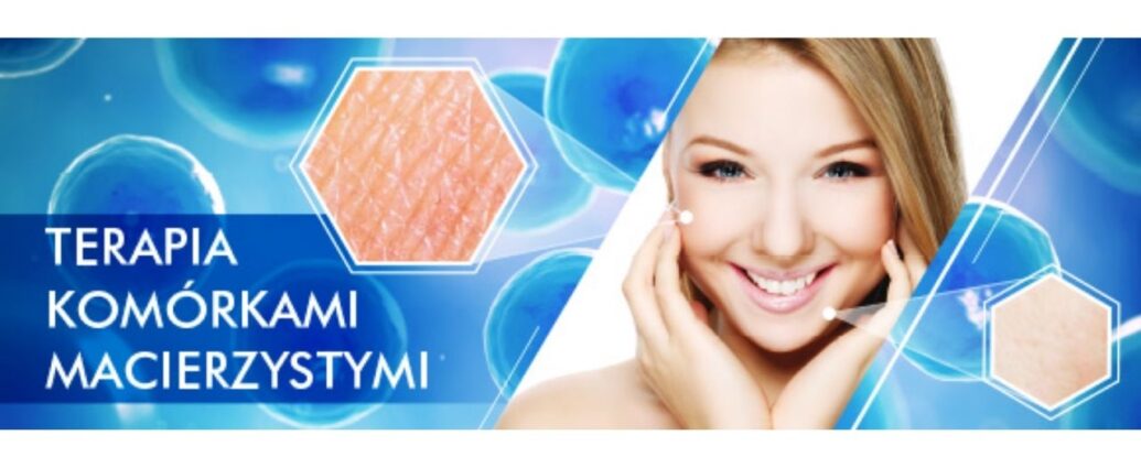 Terapia komórkami macierzystymi