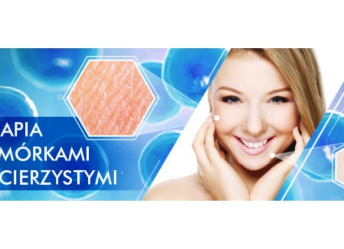 Terapia komórkami macierzystymi