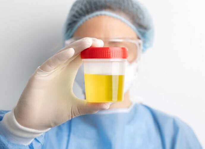 Pojemnik laboratoryjny z moczem do badania