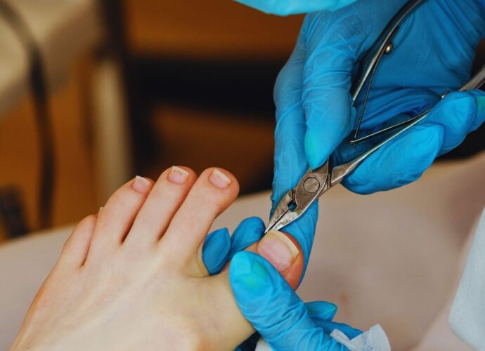 Korekcja wrastających paznokci