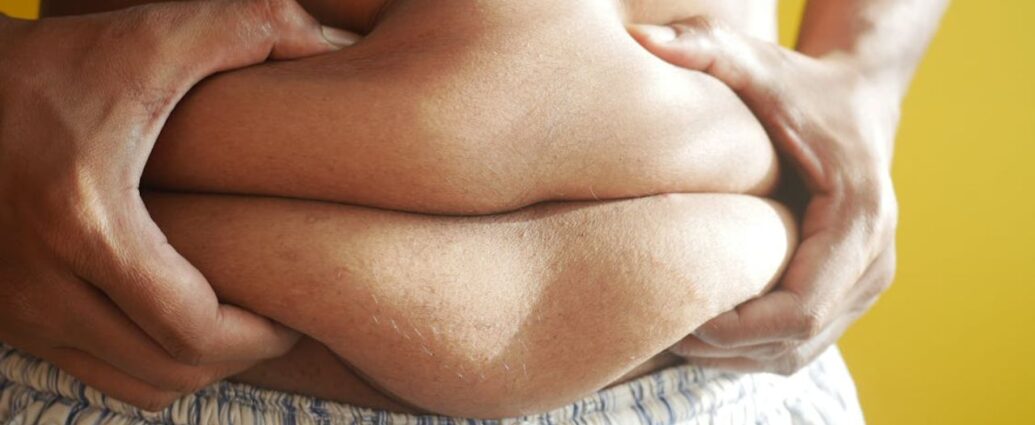 Jak skutecznie rozpoznać otyłość